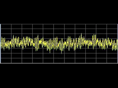 Alopecia (Hair Loss) - Rife Frequencies