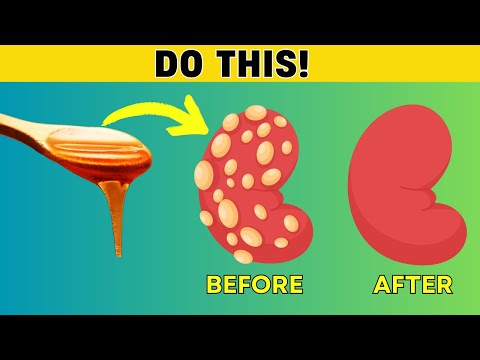 DO THIS! No Kidney Patient Will Ever Lose a Kidney Again | PureNutrition