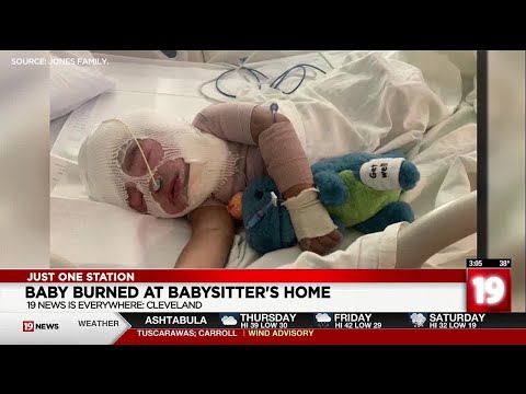 Baby burned at babysitter's home