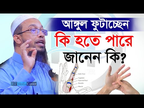 জেনে নিন কি হতে পারে! ভয়ংকর রোগ থেকে নিজেকে বাঁচান। shaikh ahmadullah শায়খ আহমাদুল্লাহ=23/01/24