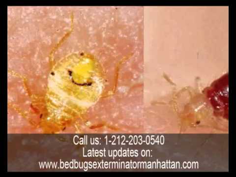 What do Bed Bugs Bites on the Human Body Look Like by NYC Pest Control Exterminator