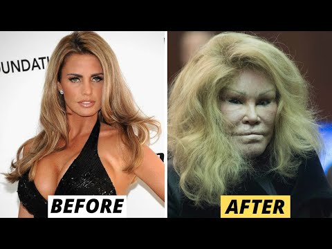 15 Celebrity Plastic Surgery Disasters