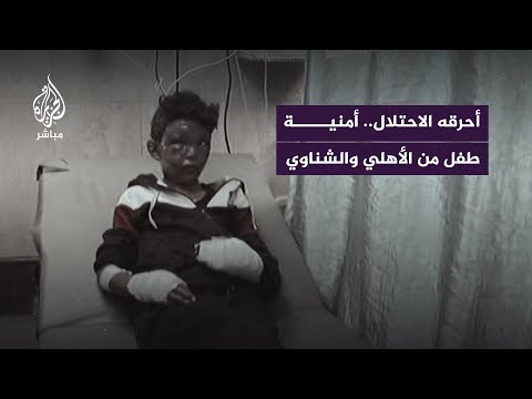 طفل مصاب في غزة يوجه رسالة إلى النادي الأهلي المصري