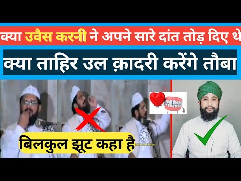 क्या हज़रत उवैस करनी ने अपने सारे दांत तोड़ दिए||kya hazrat uvais karni ne apne saare daant Tod diye