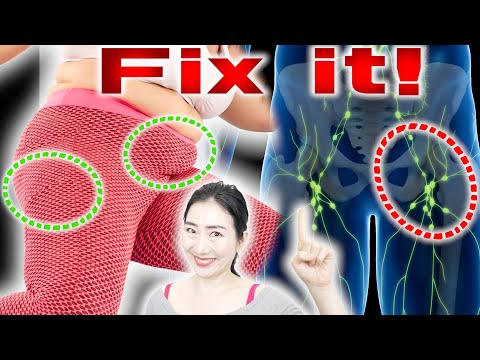 How to Best Remove Belly and Saddle Bag Fat by Draining Lymphs