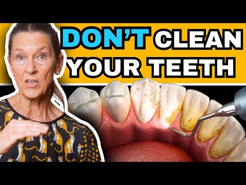 Do You really Need a Teeth Cleaning?