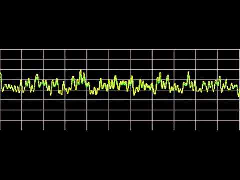 Stress - Rife Frequencies