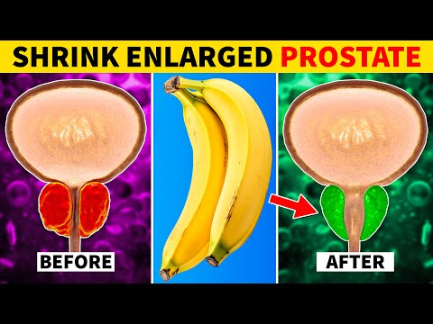 Top 8 Fruits to Shrink an Enlarged Prostate