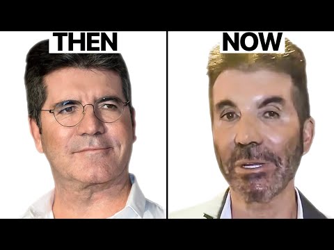 Simon Cowell NEW FACE | Plastic Surgery Analysis