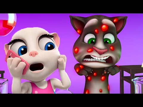 Talking Tom 🐱 Llama al doctor 🔥 Super Toons TV Dibujos Animados en Espa&ntilde;ol