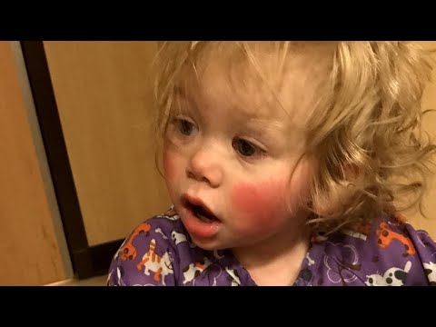 Meet 1-Year-Old Who&rsquo;s Allergic to Tears