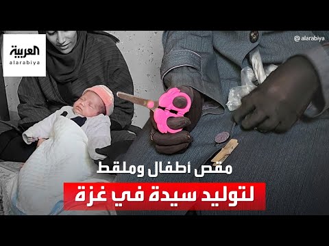 عملية ولادة صعبة دون تخدير لسيدة في غزة