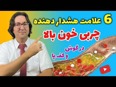 نشانه ها، علل و درمان چربی خون بالا، کبد چرب، گرفتگی و انسداد عروق به روش دکتر جاوید در 14 روز