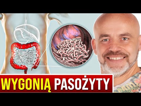 Objawy pasożyt&oacute;w i 5 produkt&oacute;w, kt&oacute;re wygonią je z ciała | Zbigniew Bańkowski