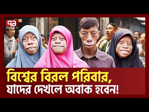 চে হারা  বি কৃতির  বি রল  রোগে ভু গছে যারা | Rarest Family In The World | Ekattor TV