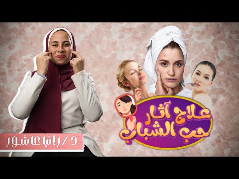 ندبات حب الشباب المزعجه 😬 وطرق علاجها والتخلص منها