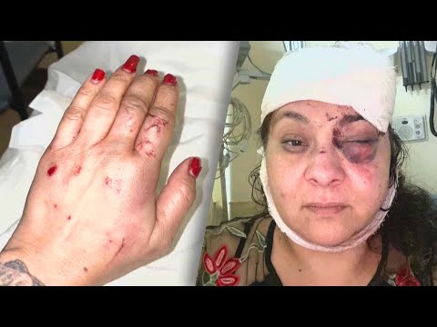 Woman Fights Back Against Attacker With Knife