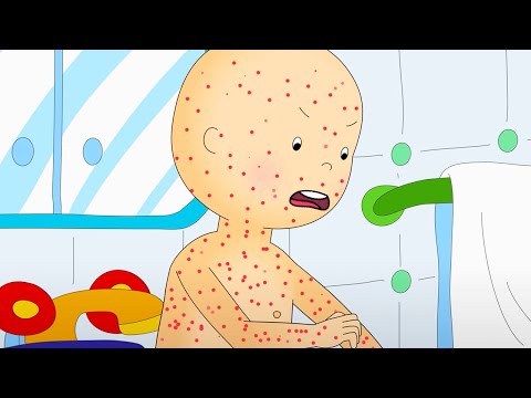 Chicken Pox | Caillou Cartoon