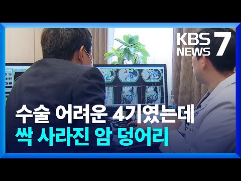 수술 어려운 4기였는데&hellip;싹 사라진 암 덩어리 / KBS  2022.10.17.