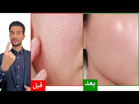 اسرع طريقة لتلميع وشد البشرة كالزجاج _التخلص من المسام الواسعة بنقطة من هذا الزيت السحري