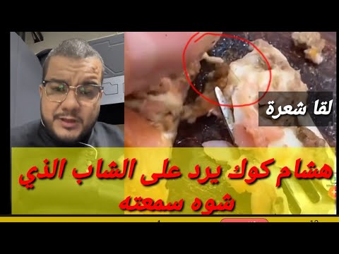 هشام للطبخ يرد على الشاب لي لقا شعرة في البيتزا وحاول يشوهلو السمعة تاعو Hicham cook