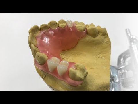 How To Make A Fiber Flex&trade; Partial - The Entire Process | Dental Lab Learning