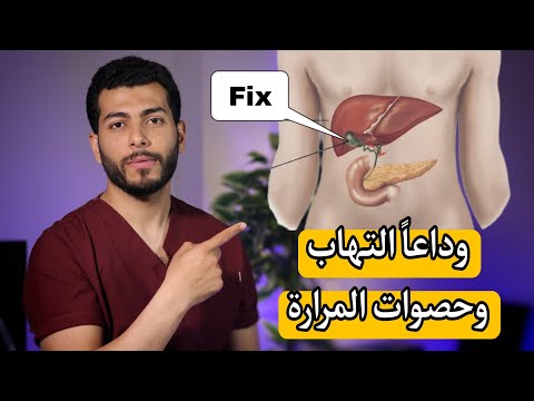 حصوات المرارة اعراضها وعلاجها نهائيا بدون جراحه |ماذا يأكل مريض المراره| اكل ممنوع ومسموح للمرارة