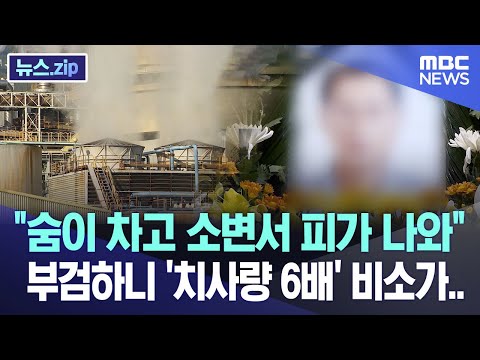 &quot;숨이 차고 소변서 피가 나와&quot; 부검하니 '치사량 6배' 비소가.. [뉴스.zip/MBC뉴스]