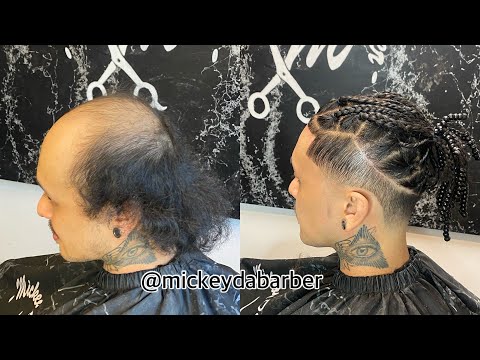 First time bleaching knots &amp; braiding plaits with a hair system ￼￼