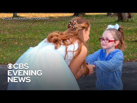 5-year-old girl with autism mistakes bride for Cinderella