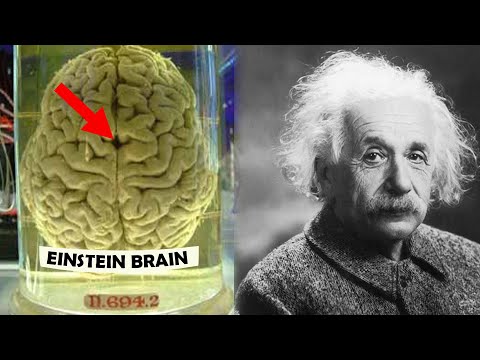 How Einstein's Brain was Different ?