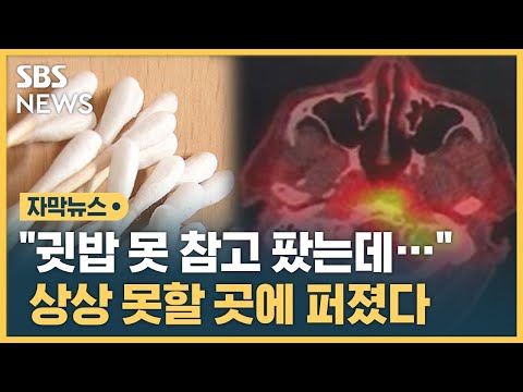 &quot;귓밥 못 참고 팠는데&hellip;&quot; 상상 못할 곳에 퍼졌다 (자막뉴스) / SBS