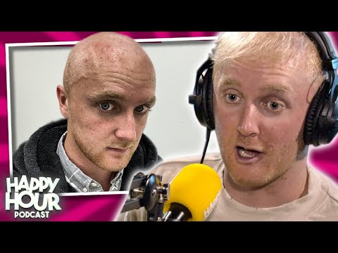 Theo Baker HONEST Opinion On His Hair Transplant