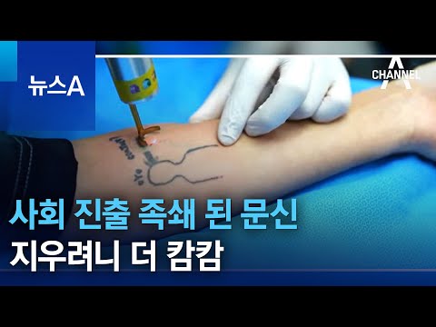 사회 진출 족쇄 된 문신&hellip;지우려니 더 캄캄 | 뉴스A