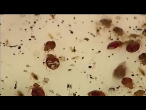 Bed bug cases are on the rise | How to spot bed bugs the next time you travel