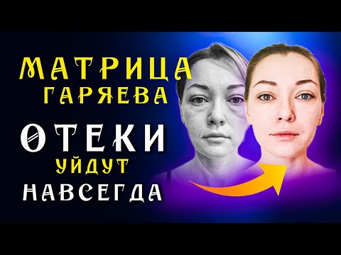 Матрица Гаряева для Очищения Лимфы ☀️ Восстановление Лимфатической Системы ☀️Исцеление Звуком