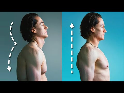 How I FIXED My Terrible Posture - 5 Habits