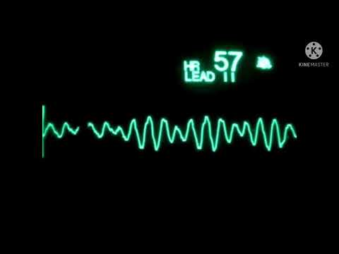 Ventricular fibrillation (VF) EKG Monitor