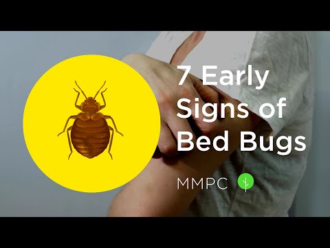 7 Early Signs of BED BUGS (How to Know if You Have Bed Bugs)