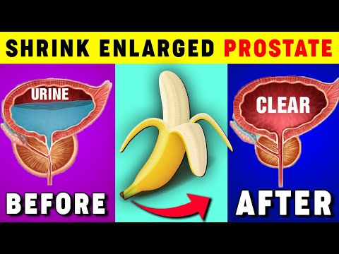 Top 4 Fruits to Shrink an Enlarged Prostate