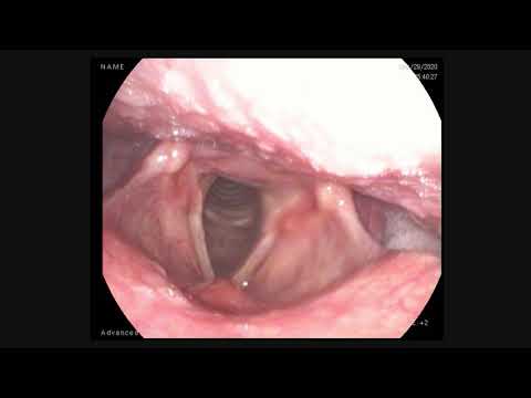 Flexible Laryngoscopy