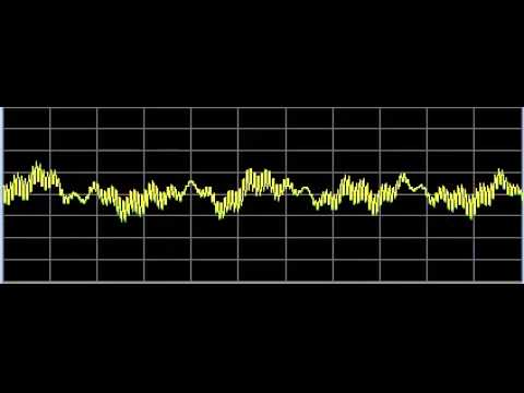 Anti-Aging 2 (Skin Repair) - Rife Frequencies