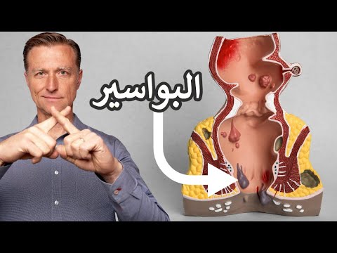 كيف تصنع أفضل علاج للبواسير في المنزل