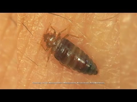 Here's Why Bed Bugs Are So Hard To Get Rid Of