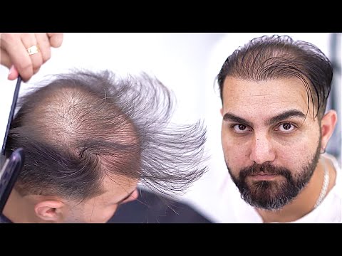 Barber's Magic on a Live Model 👨&zwj;🦲✂️ I Transforming Thinning Hair