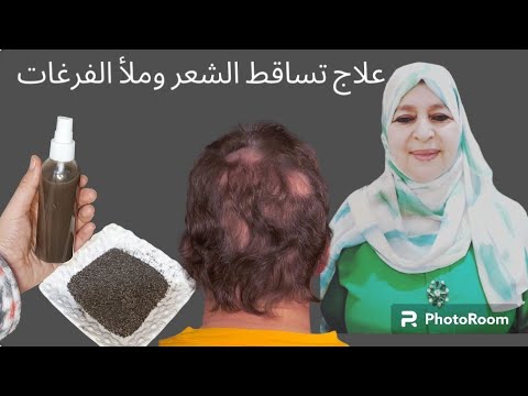 لكل واحد كعاني من تساقط الشعر او قشرة او اكزيما او صدفية في فروة الرأس علاج مضمون باذن الله