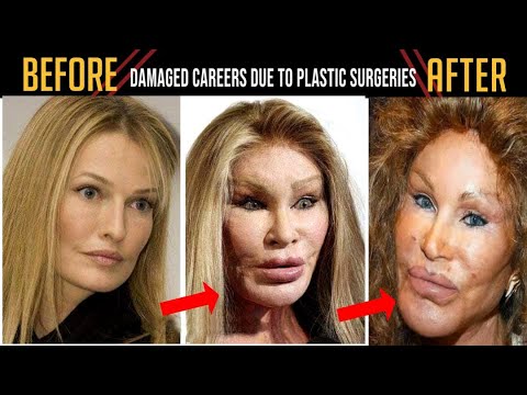 10 Celebrity Plastic Surgery Disaster