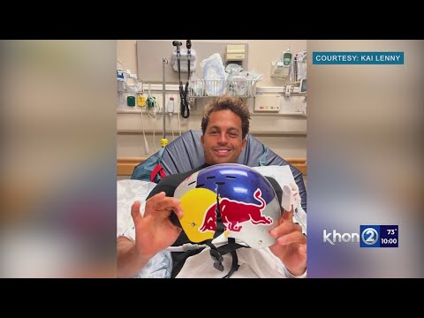 World champion surfer Kai Lenny holding his cracked helmet 'It may have saved my life'