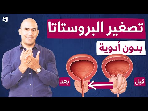 كيفية علاج تضخم البروستاتا وتكرار التبول بأفضل الأعشاب والأطعمة | اهم فيتامين يعيد البروستات للشباب