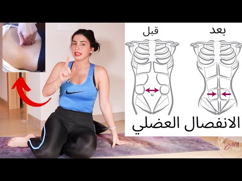 الانفصال العضلي | طريقة معرفته | حركات تجنبيها تماما !! | حركات تساعد على اغلاق الانفصال العضلي